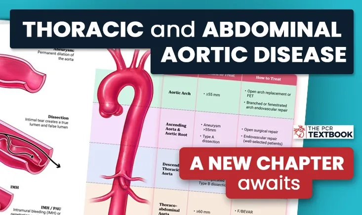 The PCR Texbook chapter on thoracic and abdominal aortic disease